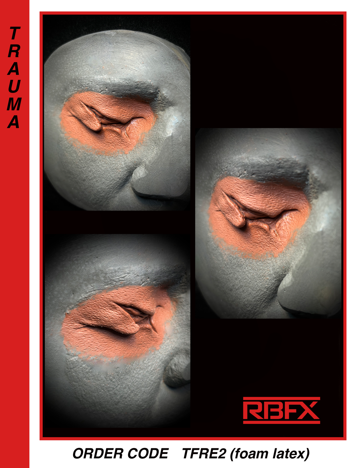 TFRE2 -Right Eye -Eye Trauma - Foam Latex