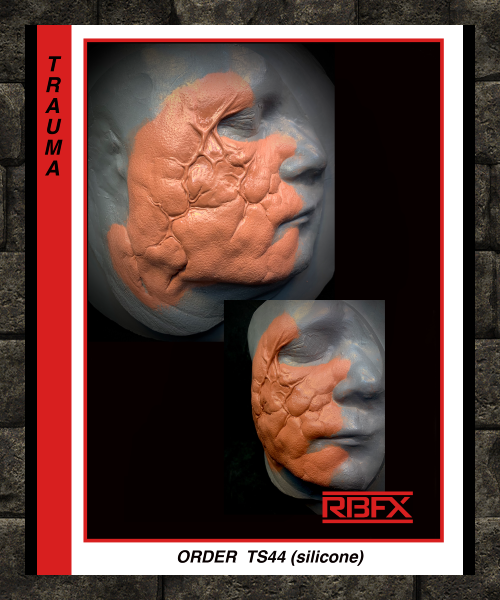 TS44 - TRAUMA CHEEK- DISFIGURED- SILICONE (7524445880578)