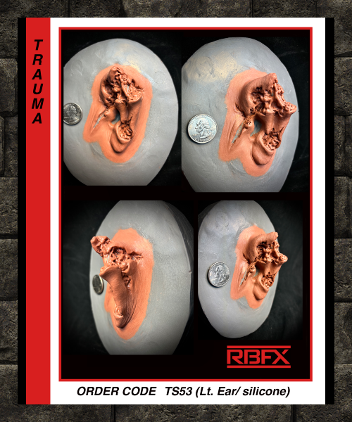 TS53 - LEFT EAR/ TRAUMA/ SILICONE - Silicone